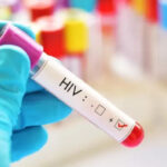 hiv